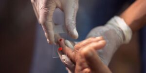 sus-comeca-a-usar-novo-tratamento-contra-a-malaria-em-criancas